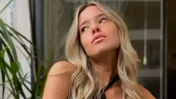 El descargo de Zoe Bogach tras su retoque estético