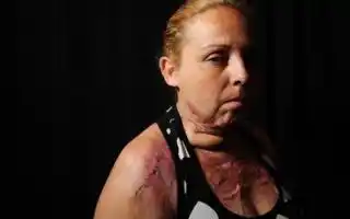 Comenzó el juicio contra un hombre que prendió fuego viva a su mujer