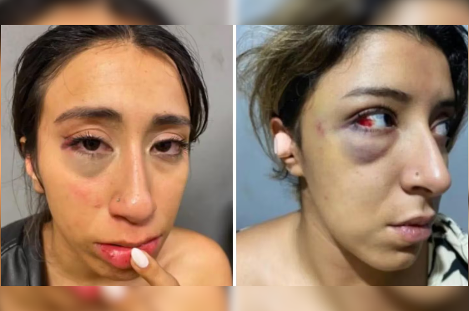 Las hermanas Silva Brandán sufrieron varios golpes en la cara y en el cuerpo. (Foto: gentileza La Gaceta)