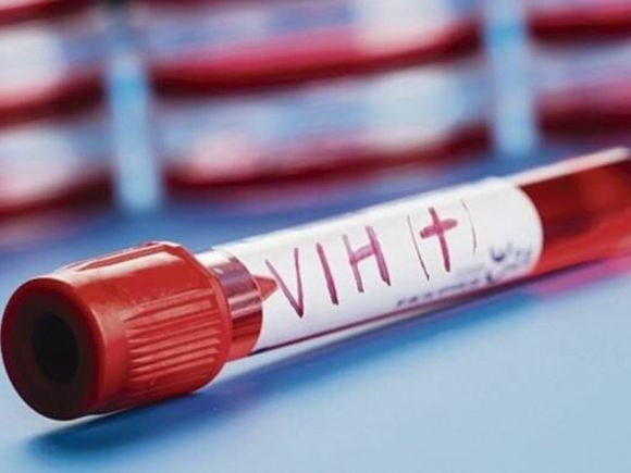 El 44% de los nuevos diagnósticos de VIH son en mujeres y niñas