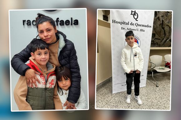 Loan ya llegó al Centro de Quemados en Buenos Aires, donde deberá someterse a varias cirugías