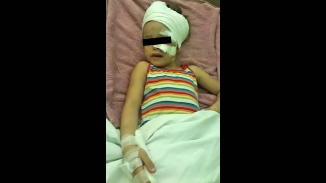 Niña fue atacada por el perro de un vecino y su familia pide que lo sacrifiquen