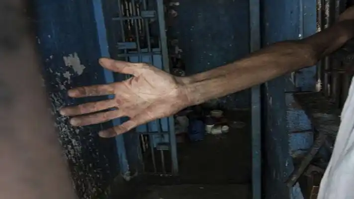 TUBERCULOSIS Y  DESNUTRICIÓN SEVERA cobró la vida de 7 reclusos en Guárico