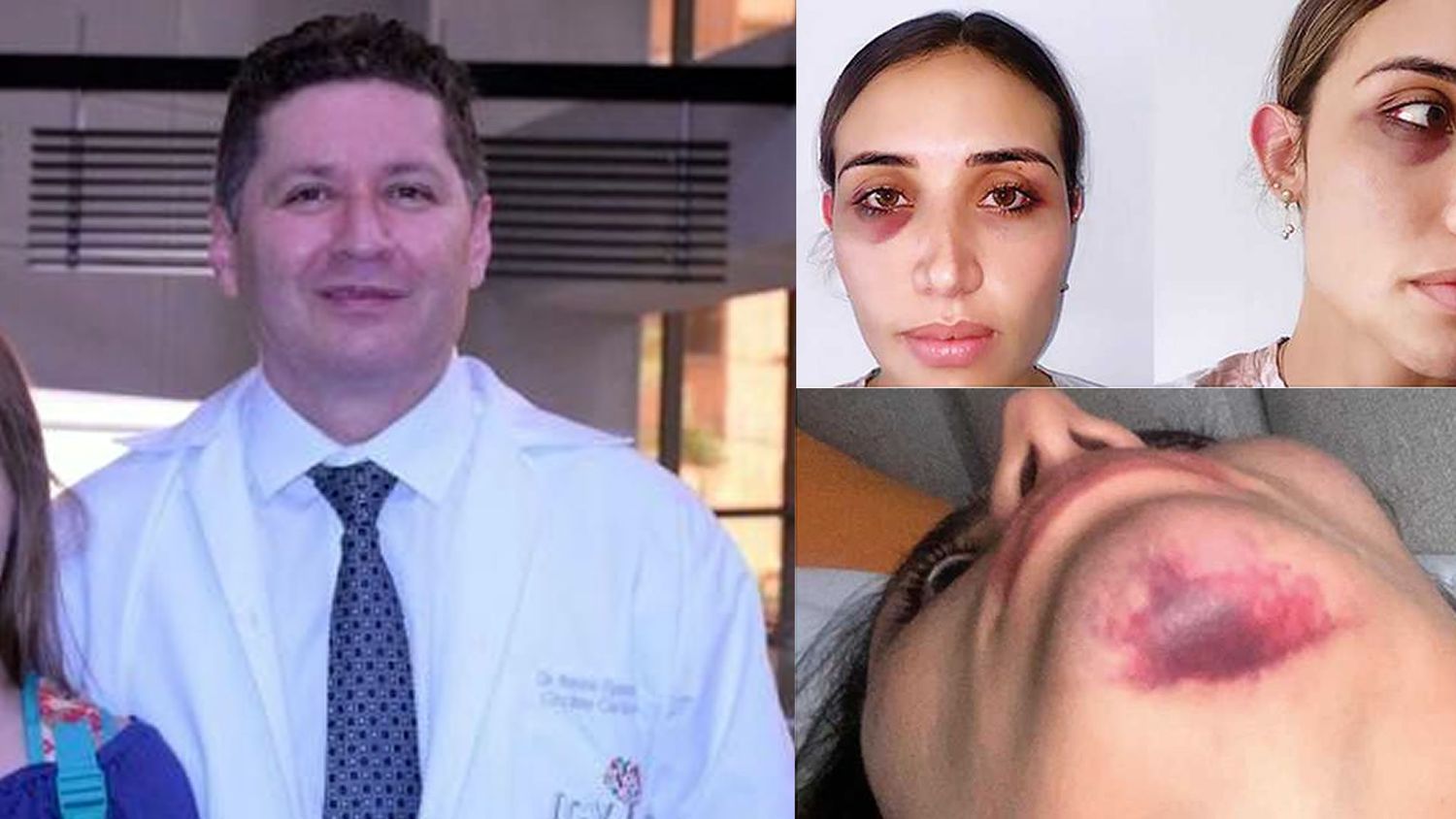 Más mujeres denuncian agresiones del famoso cirujano colombiano Antonio Figueredo