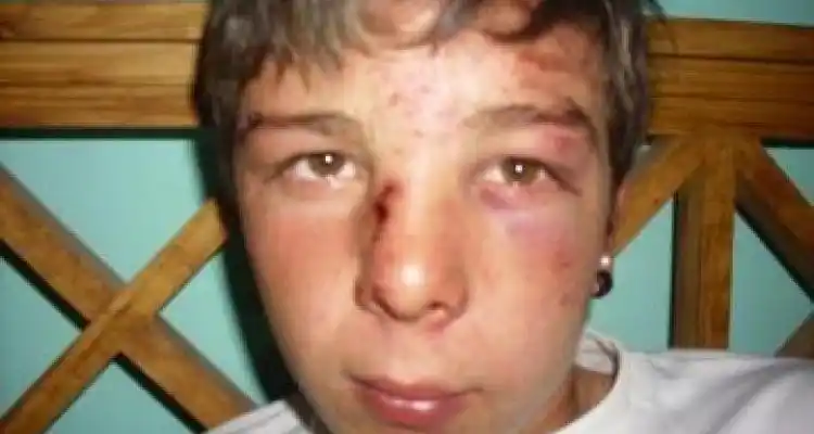 Golpiza brutal a la salida de un baile