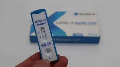 Autotest en farmacias: El 29.27% de las pruebas arrojaron resultados positivos