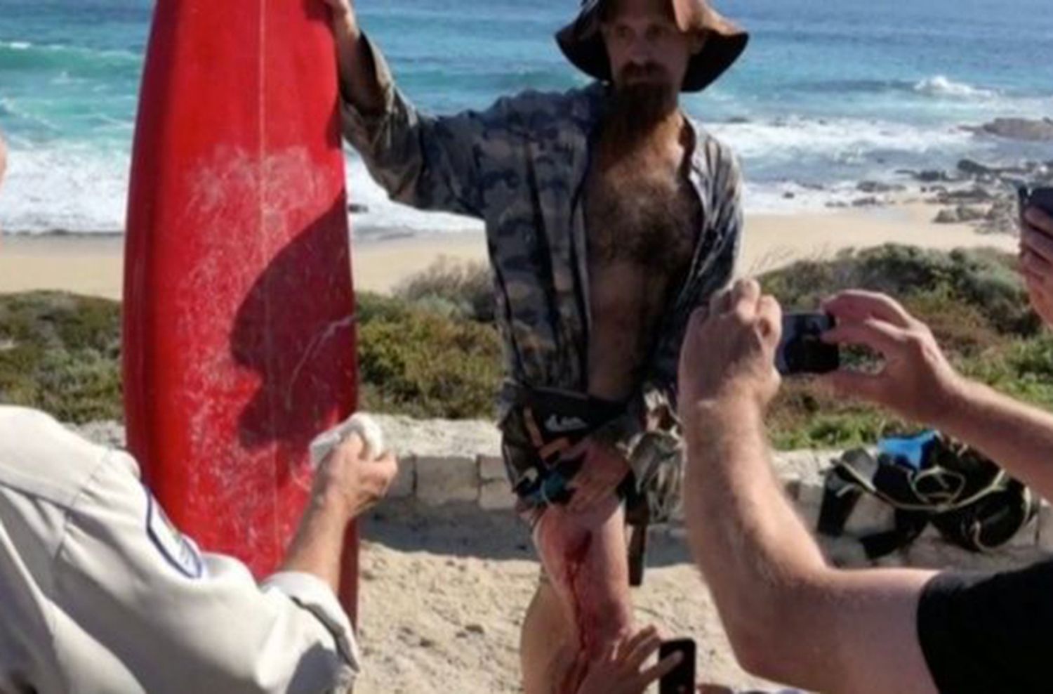 Un surfista argentino fue atacado por un tiburón