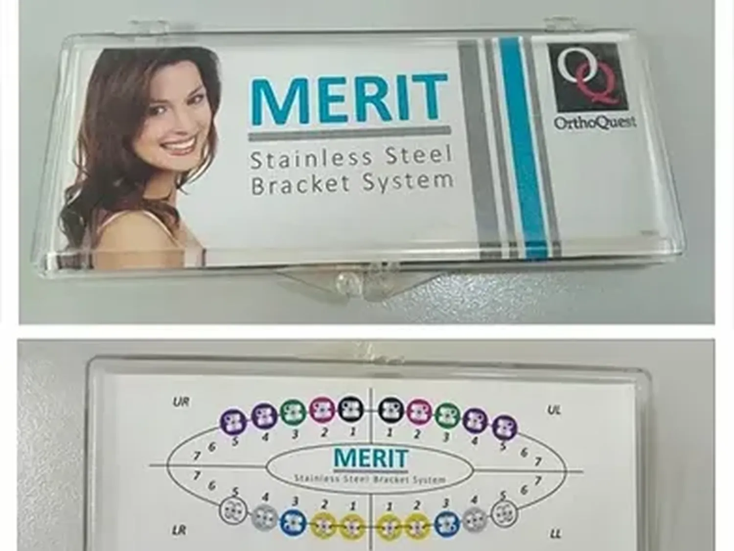 ANMAT recomienda no comprar brackets de la marca MERIT