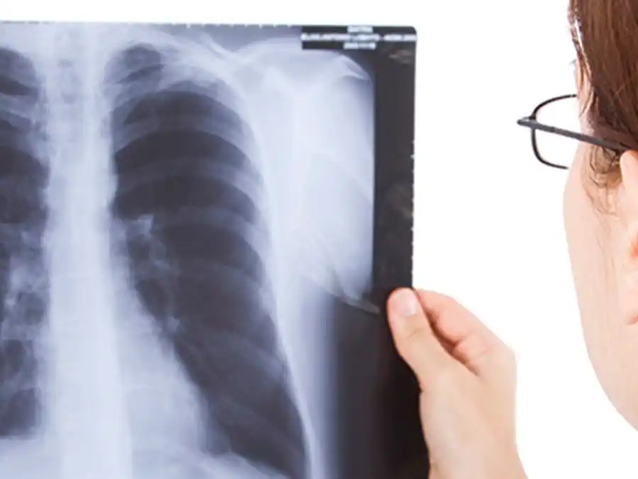 La detección temprana, fundamental para lograr la cura.