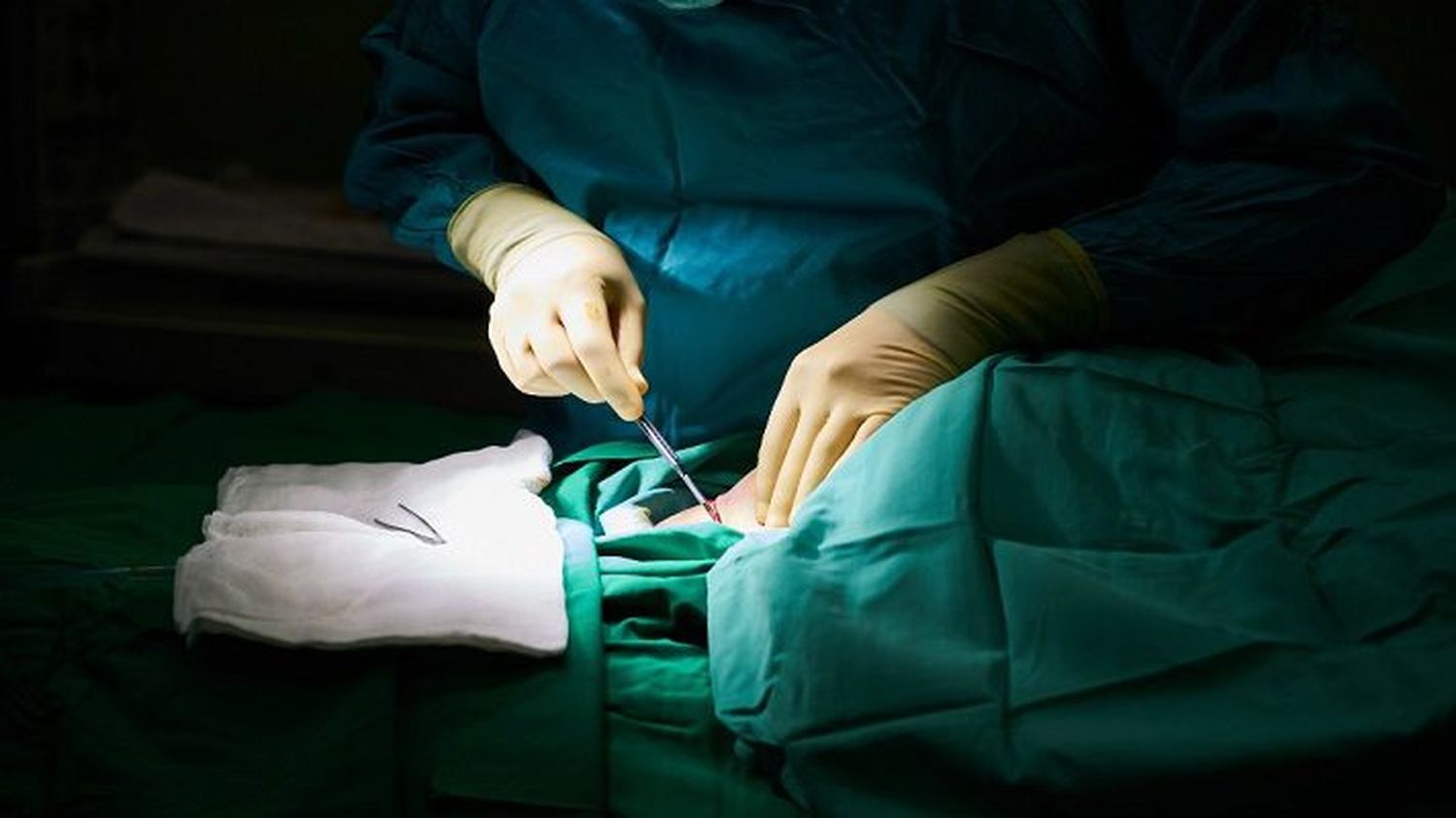 Así operaban LOS CIRUJANOS: bajo engaño sometían a las mujeres a terribles operaciones