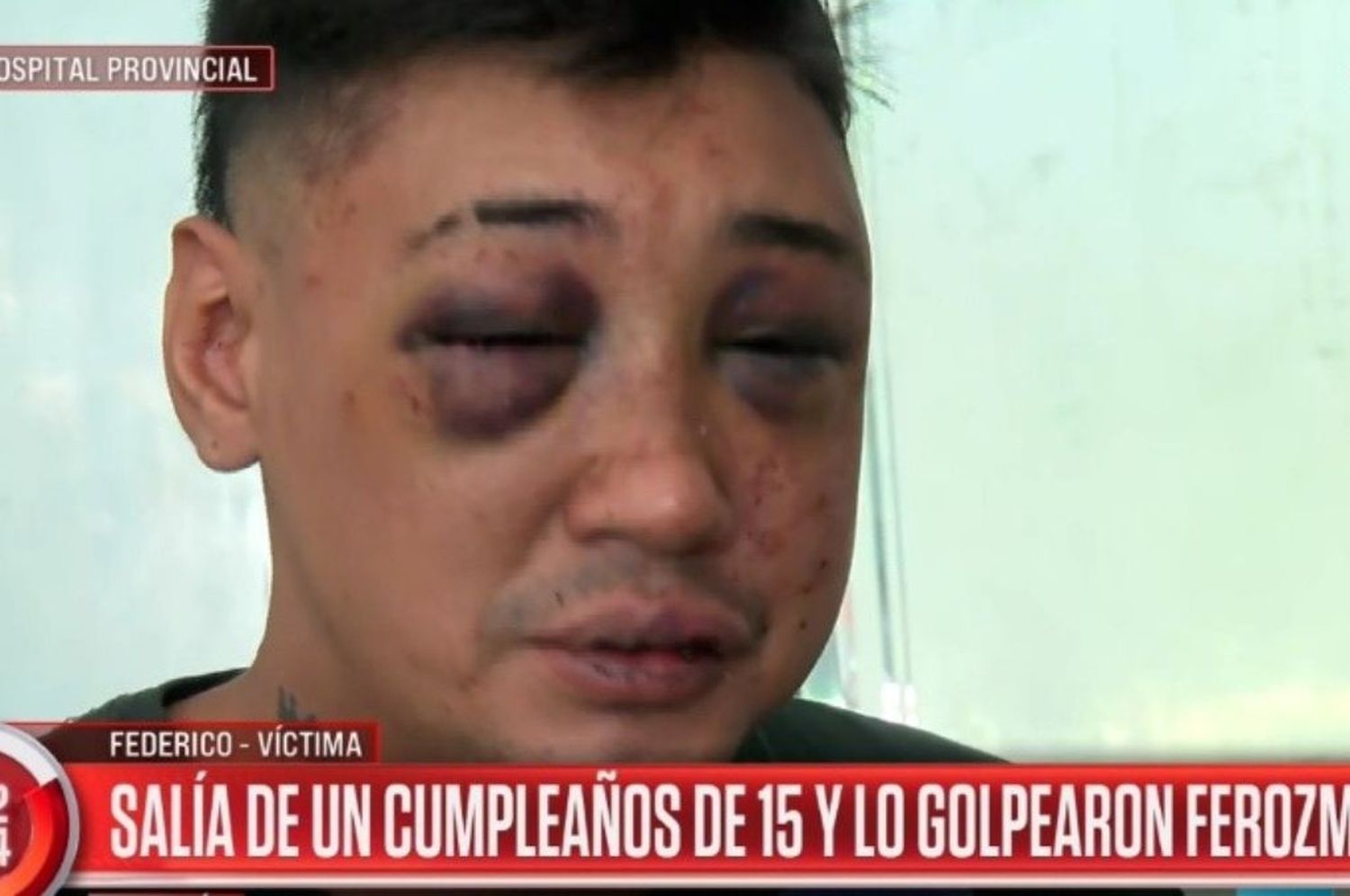 joven golpeado rosario