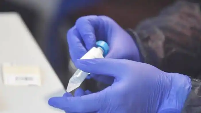 Alemania estudia sumar los laboratorios veterinarios al proceso de test covid