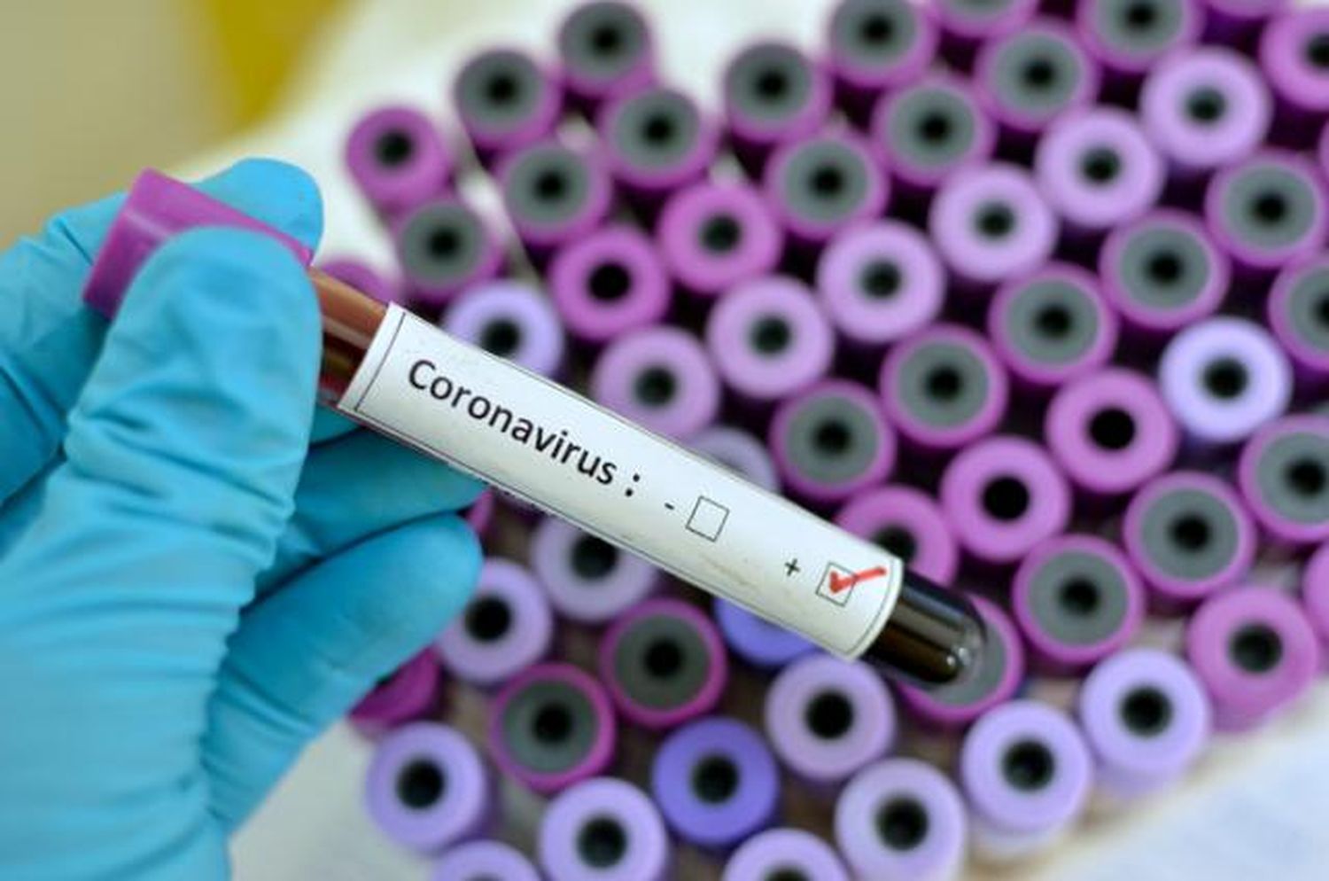 Un nuevo caso de Covid-19 y suman 23 los casos en Entre Ríos