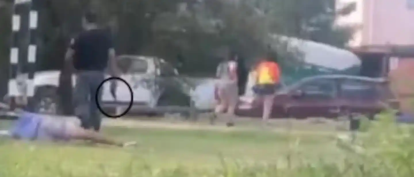 A la víctima tuvieron que amputarle la pierna.