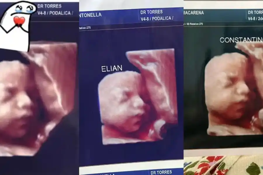 Denuncian que una clínica daba la foto de la misma ecografía para todas las embarazadas