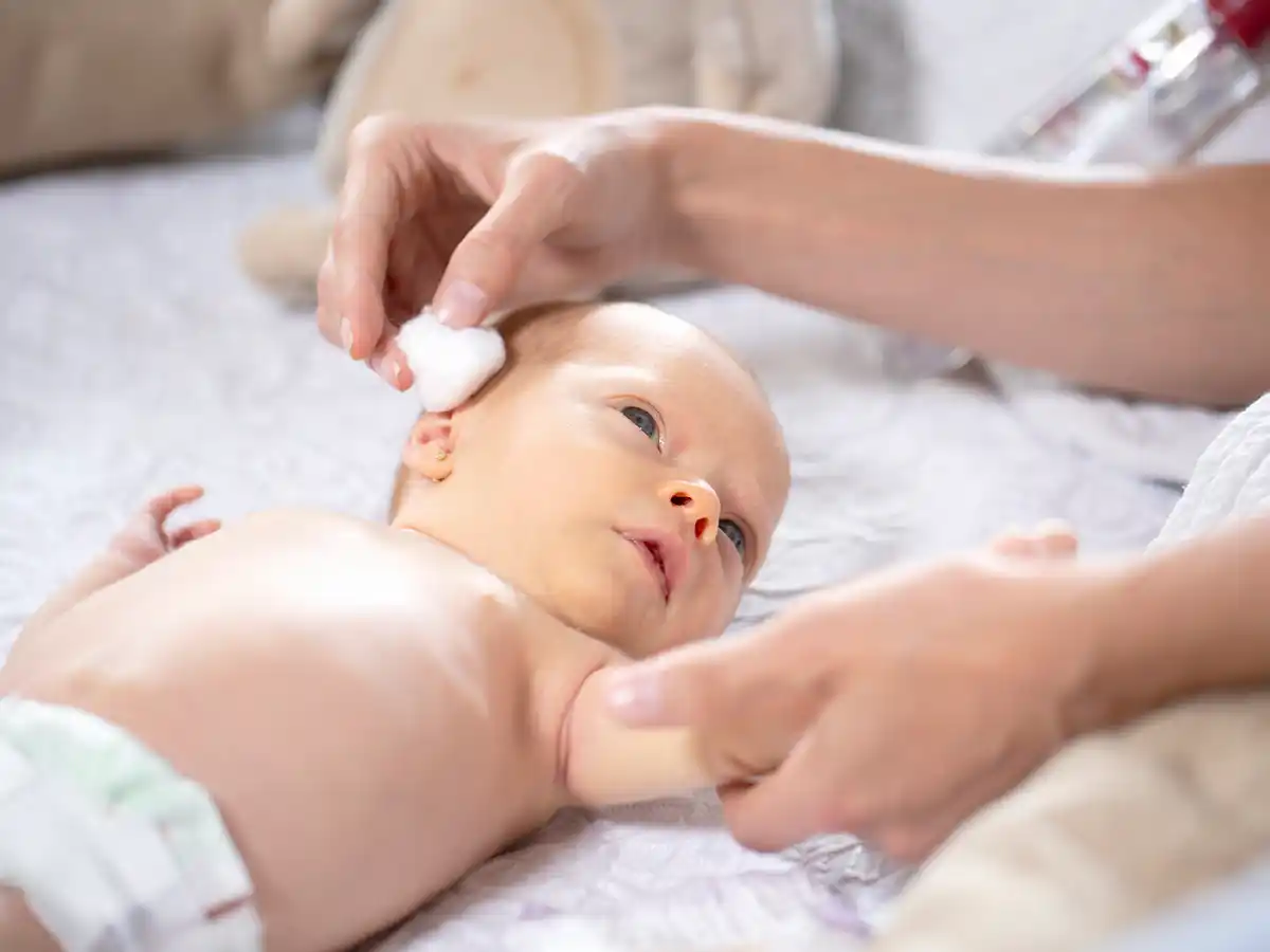 Cómo cuidar la piel del recién nacido 