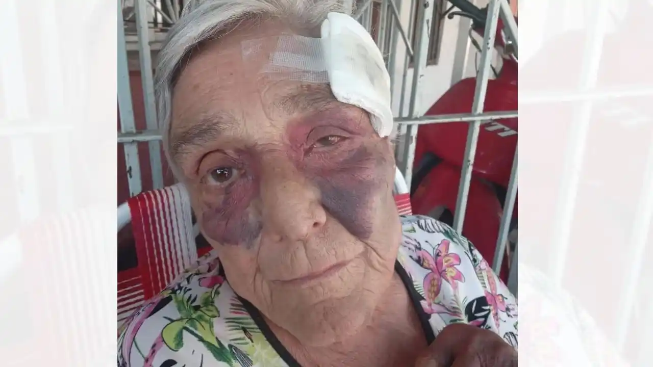 La mujer sufrió graves lesiones a raíz de los golpes.