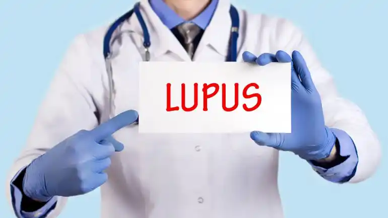 Lupus, el dolor articular que más preocupa a las mujeres