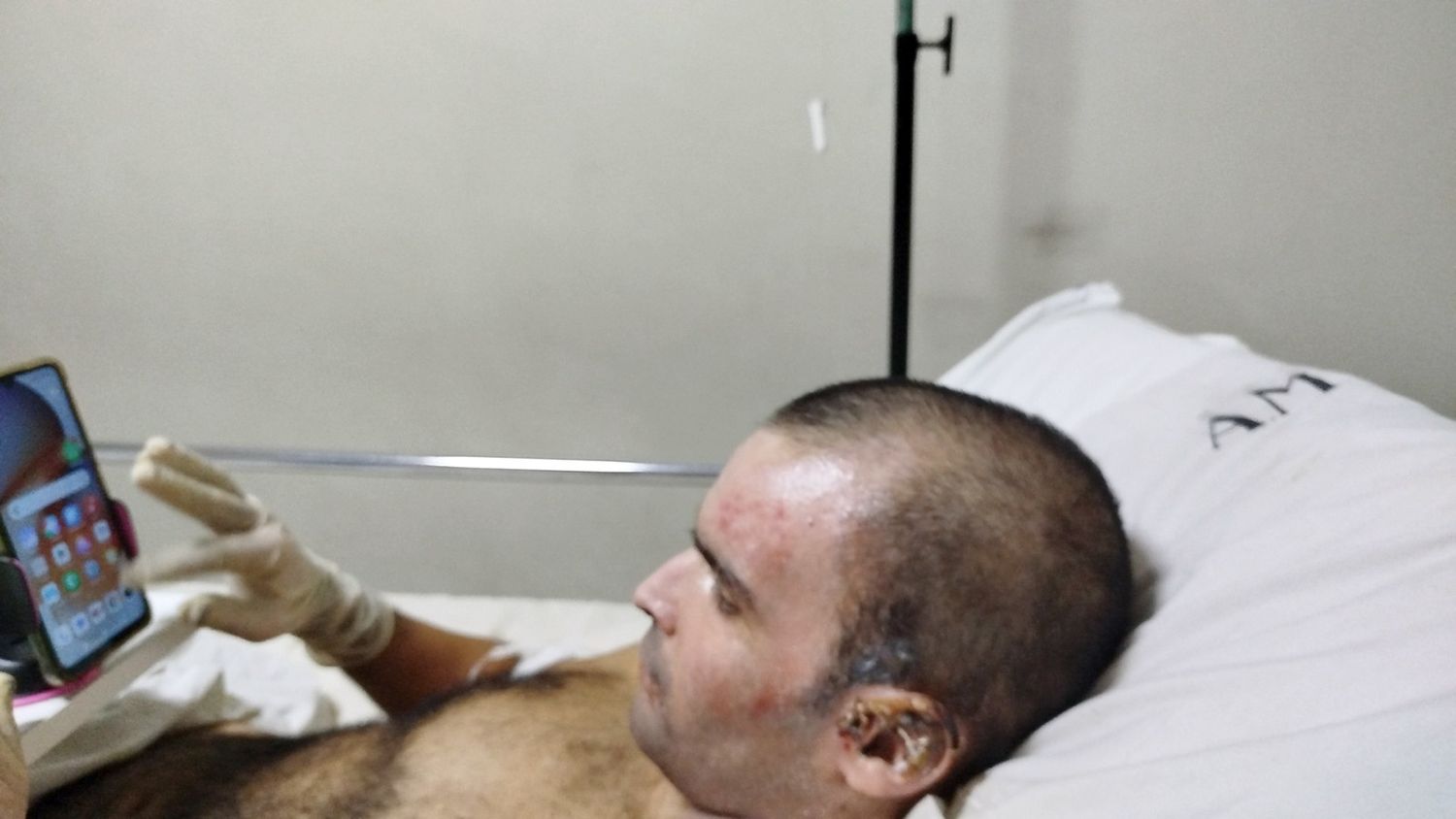 En la cama. De su habitación en un centro asistencial capitalino, Damián Millán, se recupera de las lesiones