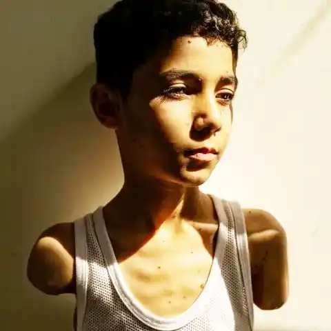 La imagen de un niño mutilado en Gaza ganó el premio a la Foto del Año