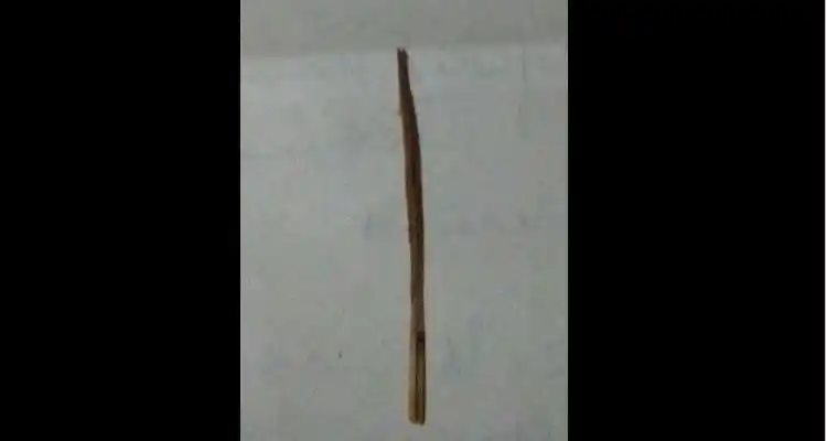 Tiene 5 años, se tiró del tobogán de la Plaza de la Amistad y se clavó una astilla de 5 centímetros en la cola