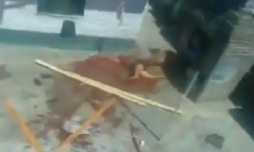 Paraná: Sangriento ataque de un perro a una mujer 