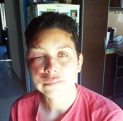 Golpeó y lastimó a una mujer para robarle sus pertenencias