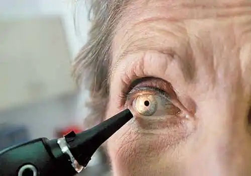 Lanzan una campaña para prevenir la ceguera producto de la diabetes