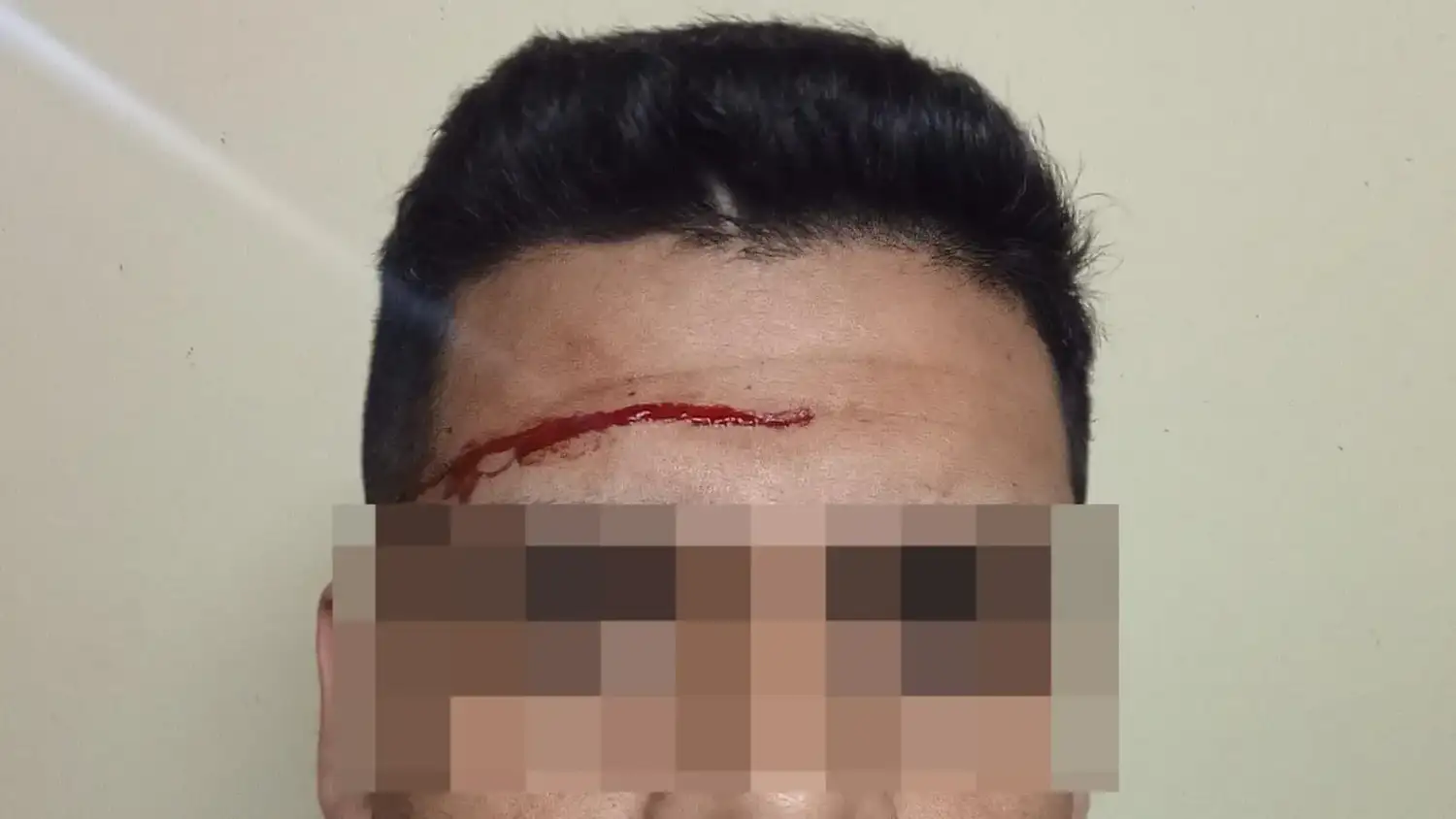 Un hombre fue detenido por atacar a un policía con un destornillador: le hirió un ojo y le cortó la frente