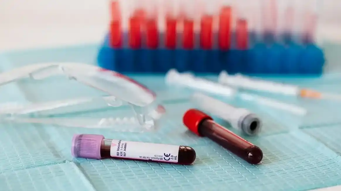 Detectaron en Argentina casos de un grupo sanguíneo extremadamente raro: importancia y desafíos para el sistema de salud