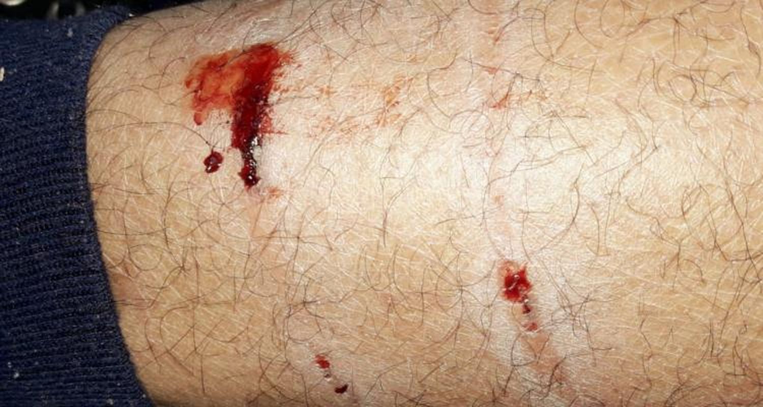Perros callejeros mordieron a un mensajero en Mitre y San Martín