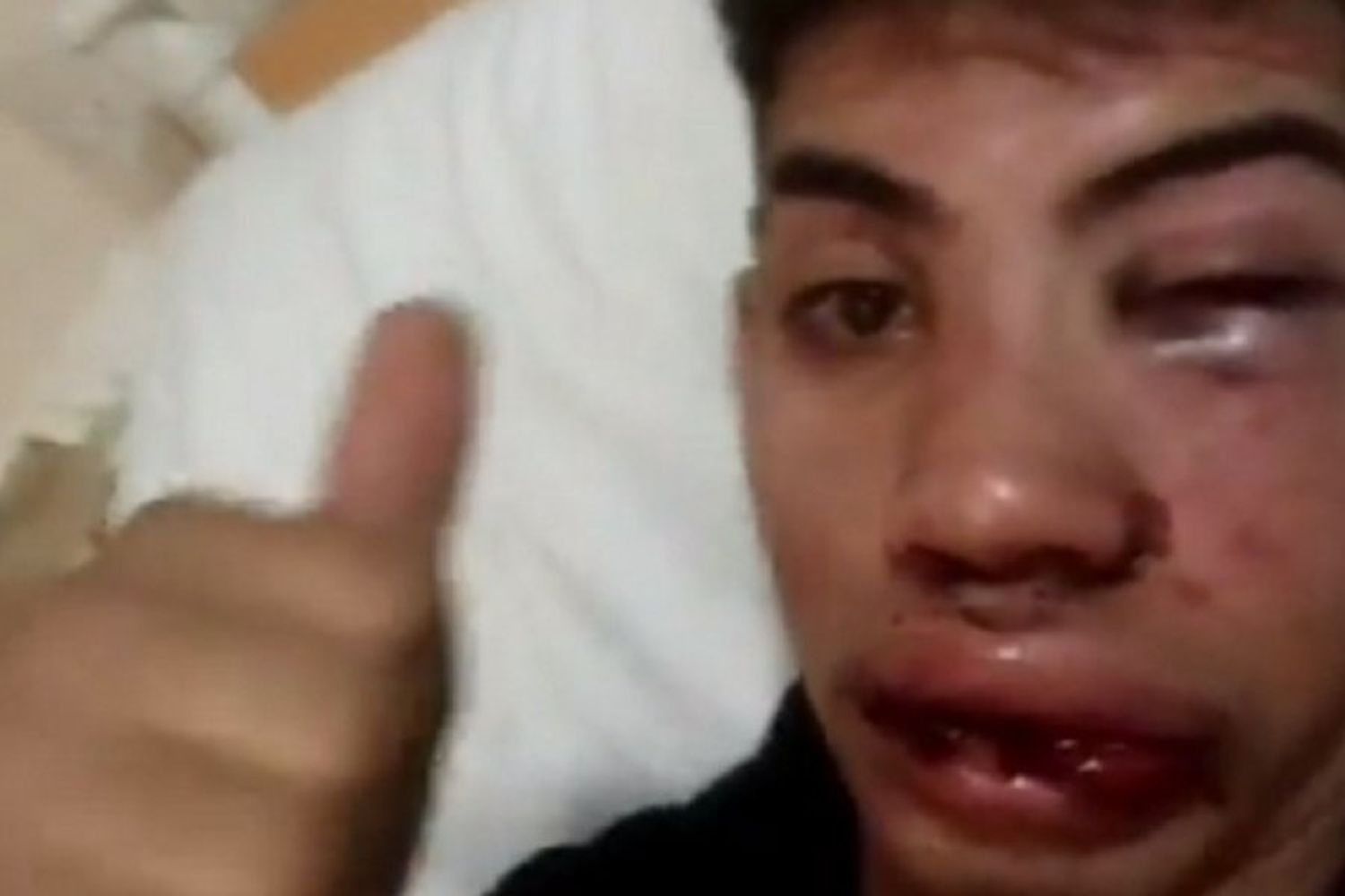 VIDEO | Brutal golpiza a un joven en Casilda por una pelea de tránsito: “Podrían haberlo matado”