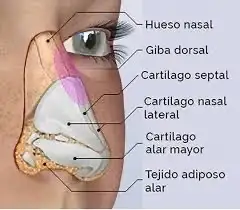 Reconstrucción nasal con cartílagos autólogos