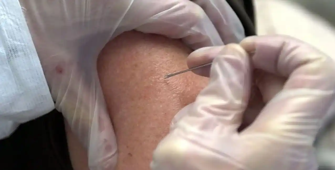 Advierten sobre un brote de la viruela del mono en España y Portugal