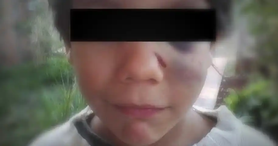 Azotó a su hijo con un cable, la escuela lo denunció y se lo quitaron