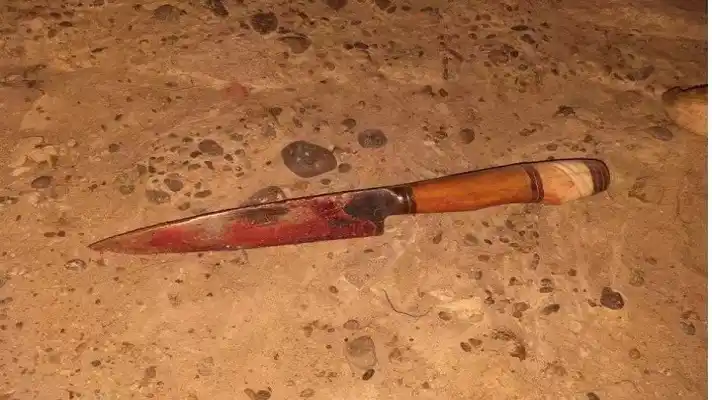 Lo apuñalaron en el rostro por resistirse a un robo