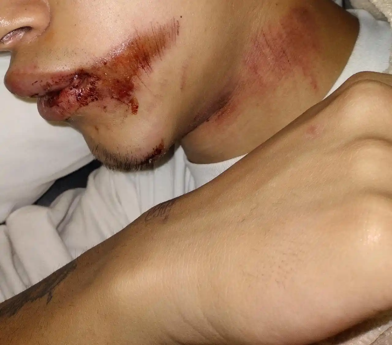 Joven Golpeado en Sol Disco