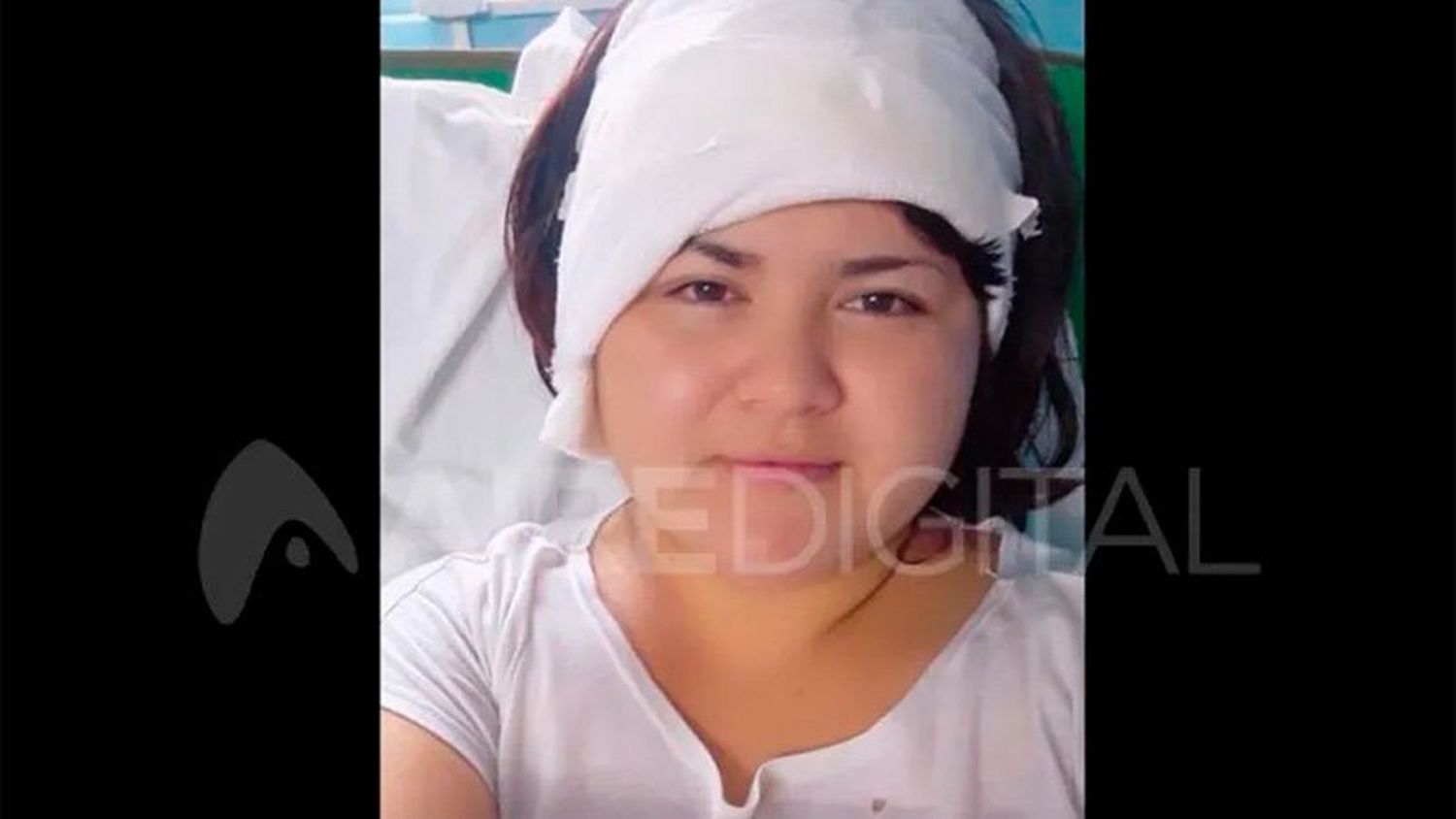 La mujer se recupera en el Hospital Cullen, de Santa Fe