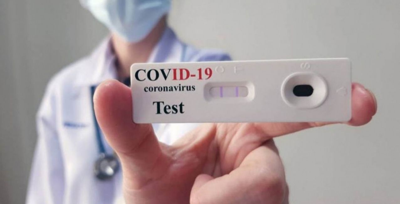 Autotest: se informará el resultado a las farmacias y éstas al Gobierno