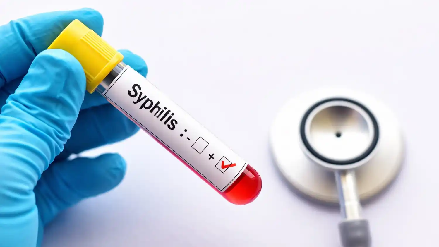 En 2025 los casos se incrementaron un 71% respecto a años anteriores.