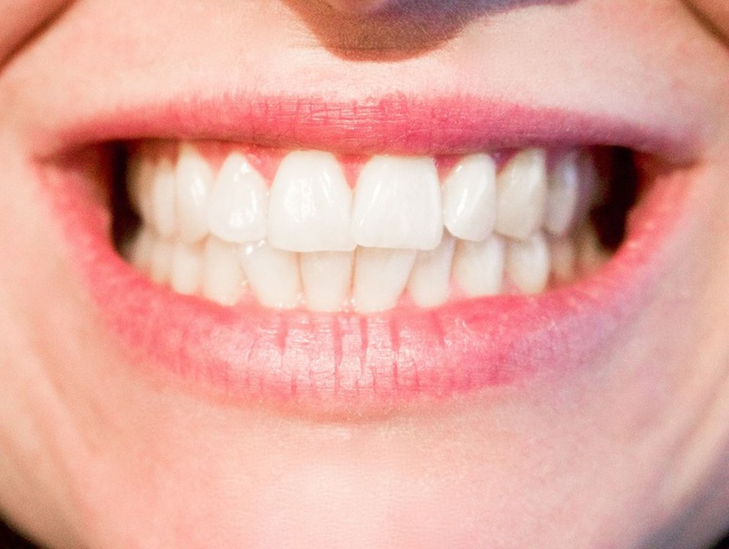 ¿Por qué se mueven los dientes?