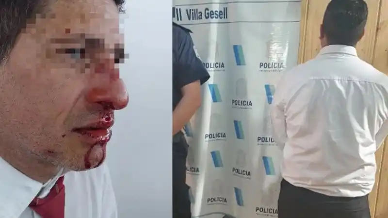 gesell chofer agresion