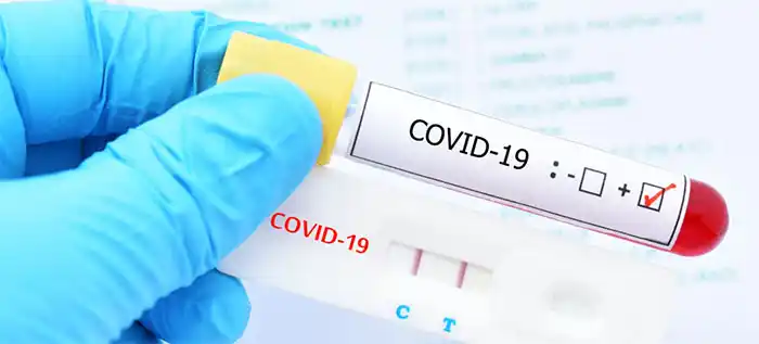 Covid: 11.000 casos negativos