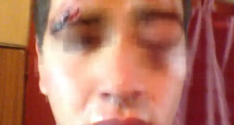 Río Tala: Denuncian que un joven fue brutalmente golpeado durante un cumpleaños