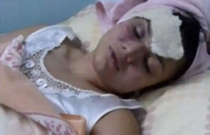 Un jugador de Boca desfiguró a su novia porque lo encontró con otra