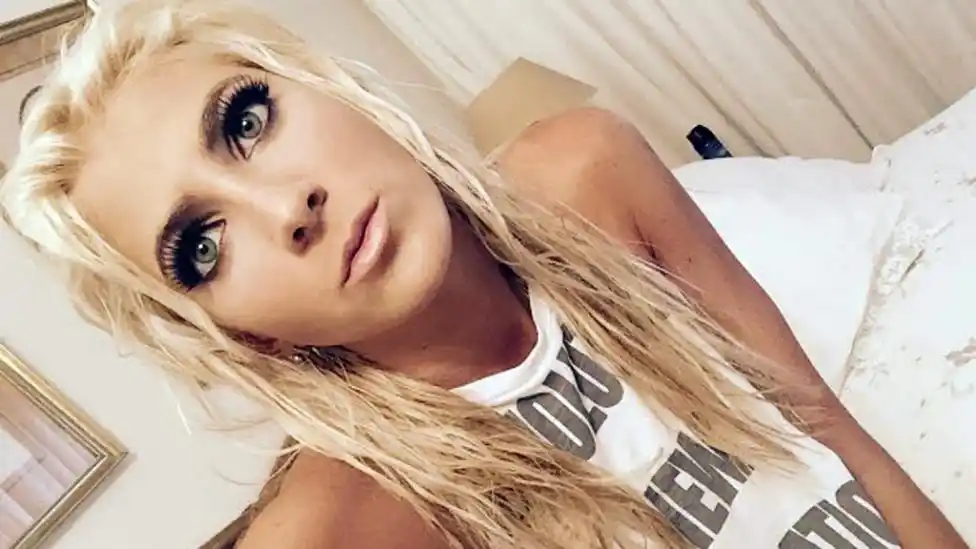 Cande Ruggeri compartió una foto en Instagram y preocupó a todos