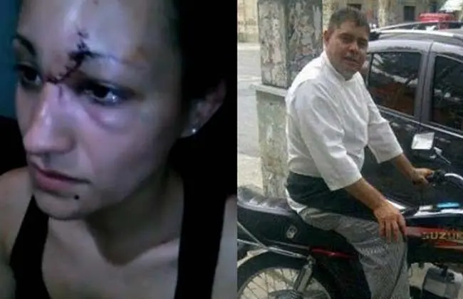 Violencia de género: Detuvieron al hombre que desfiguró a su expareja