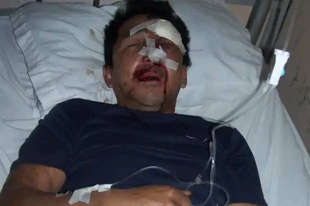 Justicia por mano propia: entraron a robar, pero terminaron en el Hospital