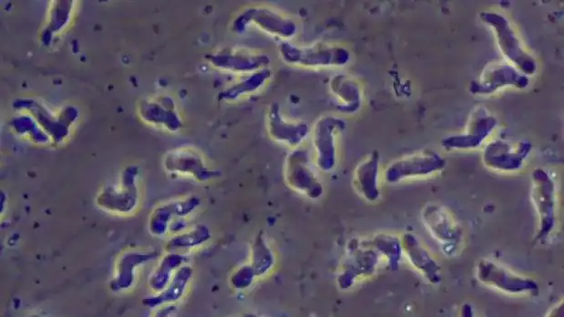 Murió un nene por la "ameba come cerebros": es el primer caso registrado en el país