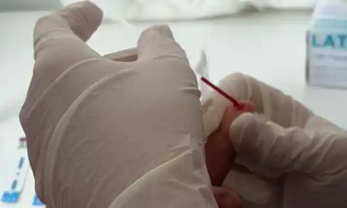 Se realizará una nueva jornada de detección rápida de VIH/SIDA